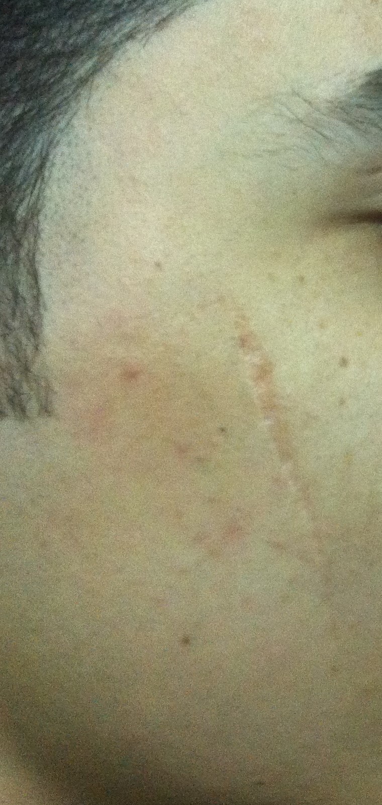 Botox, Restylane, Liposuction, Scar, Best Plastic Surgery Egypt, Laser, Vaser