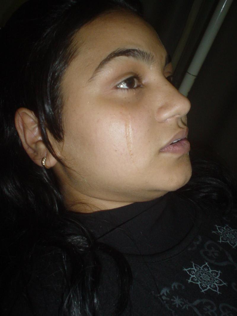 Best Cosmetic surgery in Egypt, Cheek Surgery, Scar Surgery, Stem Cells, Laser