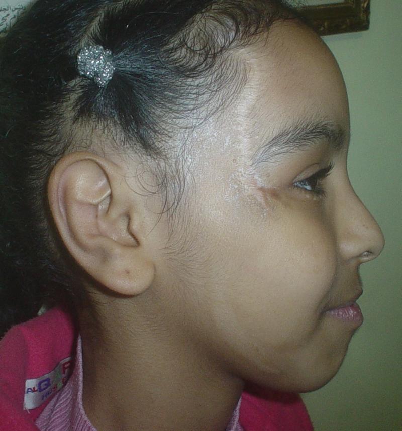 Best Plastic Surgeon Egypt, Breast Augmentation, Scars,Botox Mastopexy,Mammopex