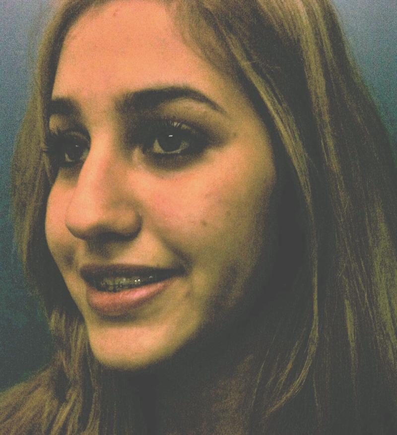 Best Plastic Surgery Egypt, Cheek Dimple, Dynamic cheek, Face surgery, Liposucti