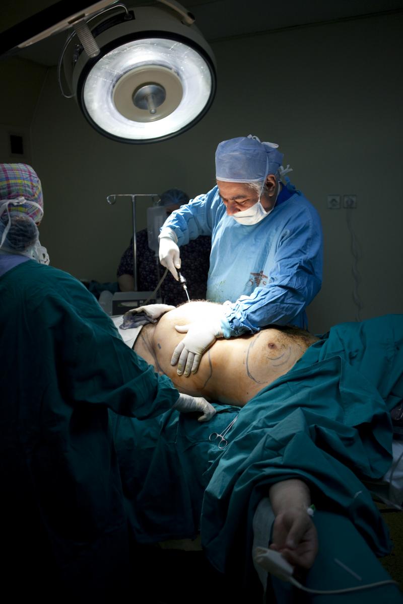 Plastic Surgery Egypt,Aesthetic Surgery,Laser liposuction,Smart liposuction