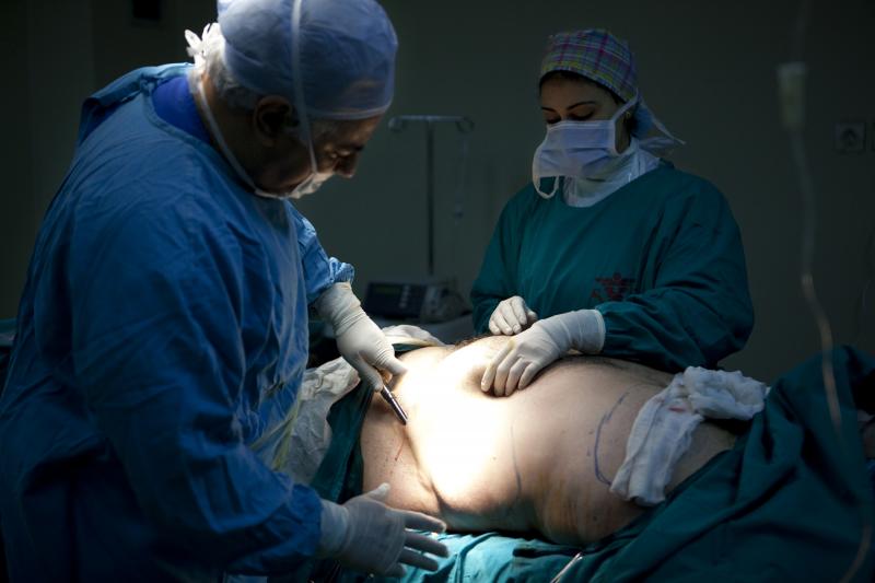 تكميم و تدبيس المعدة و علاج السمنة و افضل جراح تجميل في مصر و التخسيس و شد الجسم