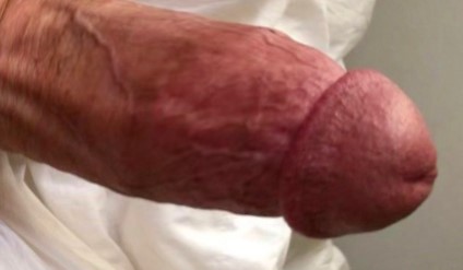 Penile Enlergement, Release of Suspensory Ligament, Hyaluronic Ac Penis, Cosmeti