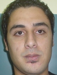 Plastic Surgery Egypt,Cosmetic,face lift,fracture,aesthetic surgery,Cairo,trauma