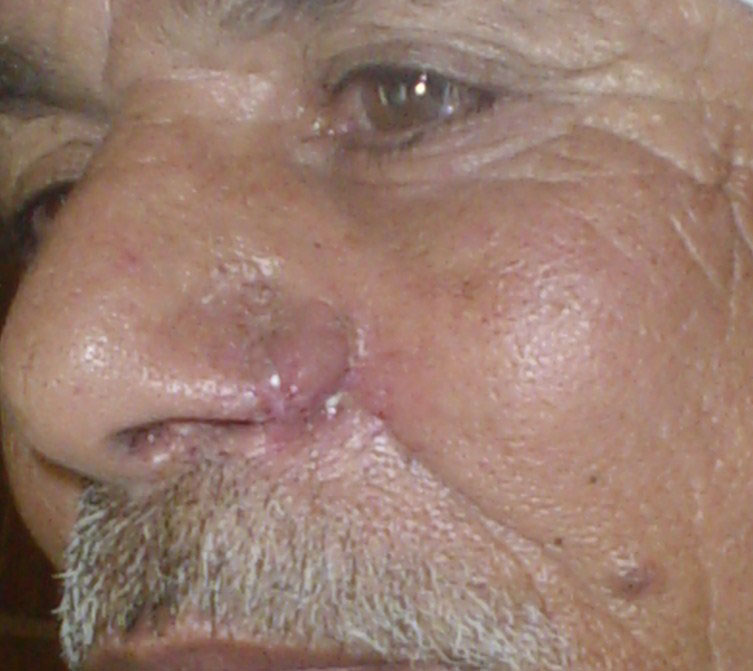 Plastic Surgery Egypt Cairo Face lift nose job liposuction tumors