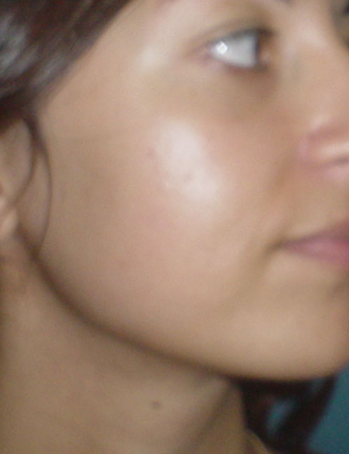 Plastic Surgery Egypt, Lipolysis, Neck lift, Face lift, Sculpturing, Jaw-line