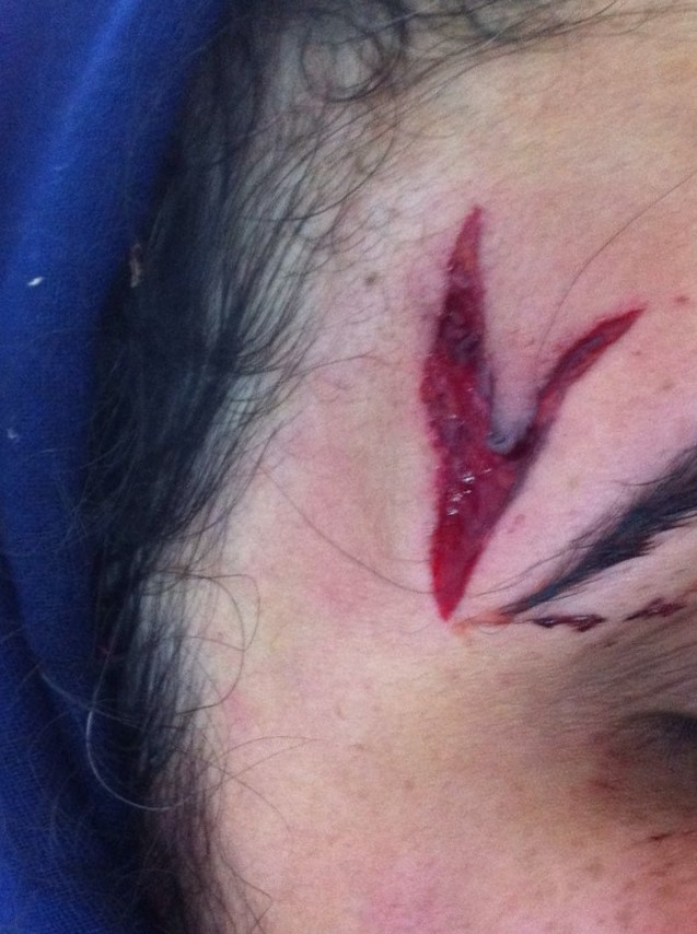 Best Plastic Surgery, Scar Removal, Botox Injection, Face Surgery, Face Wrinkles