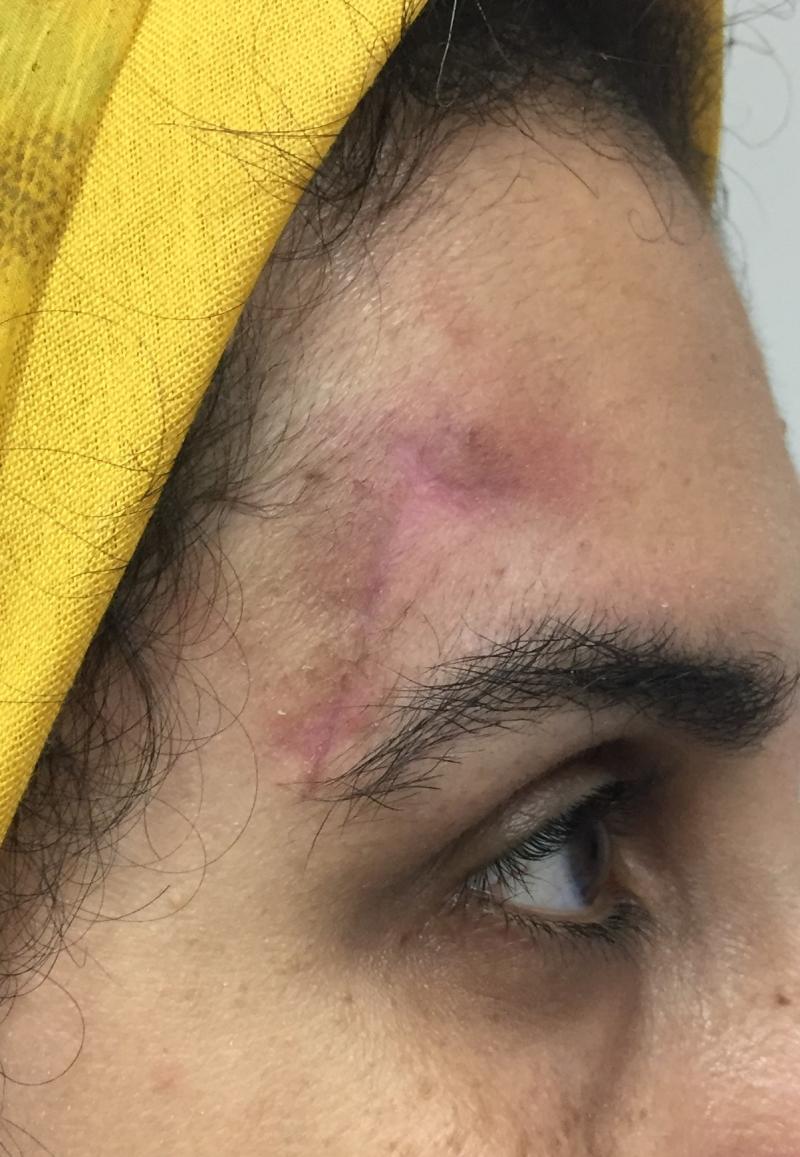 Best Cosmetic Surgery, Scar Removal, Botox Injection, Face Surgery, Face Wrinkle