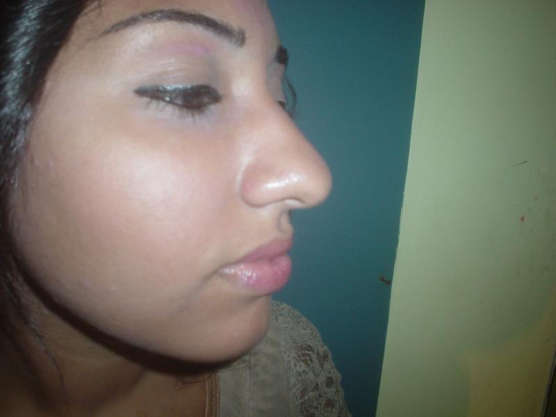 Plastic Surgery in egypt,Aesthetic Surgery in Egypt,Cosmetic Surgery in Egypt