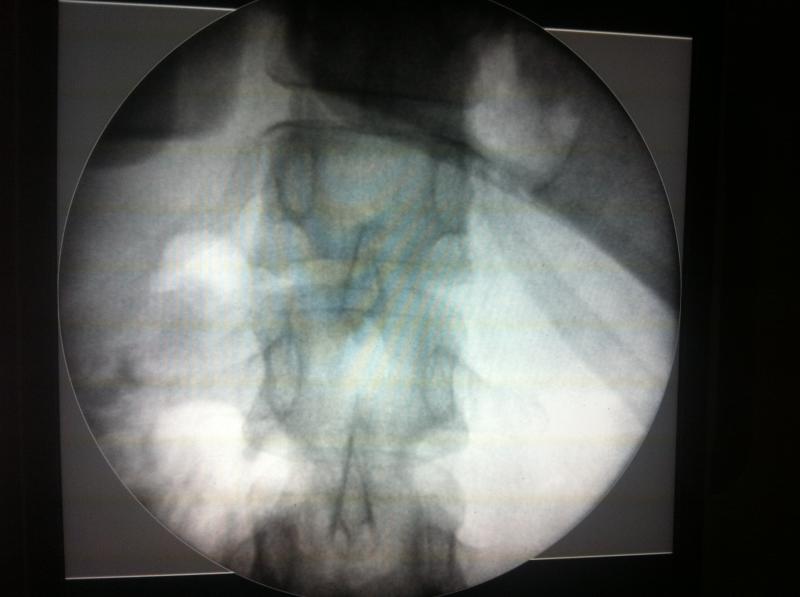 Sleeve Gastrectomy Egypt, Obesity Surgery Egypt, Bariatry Egypt, Plastic Surgery