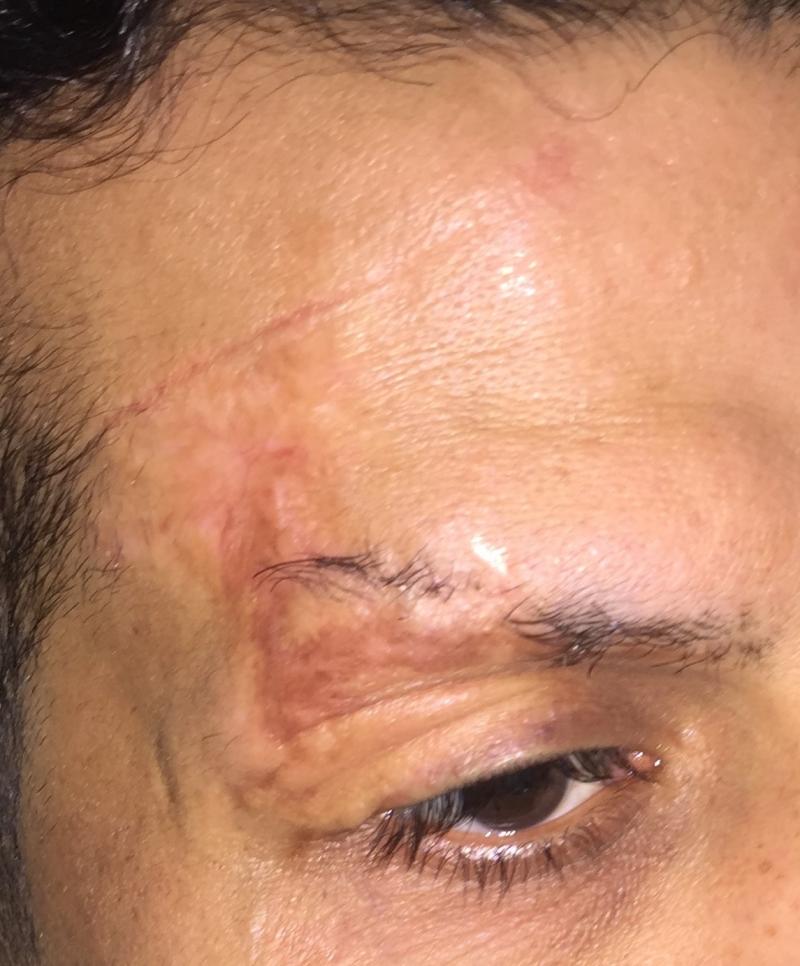 اقضل جراح تجميل في مصر زراعة الشعر و زراعة الخلايا الجزعية و اصلاح الجروح الندبة