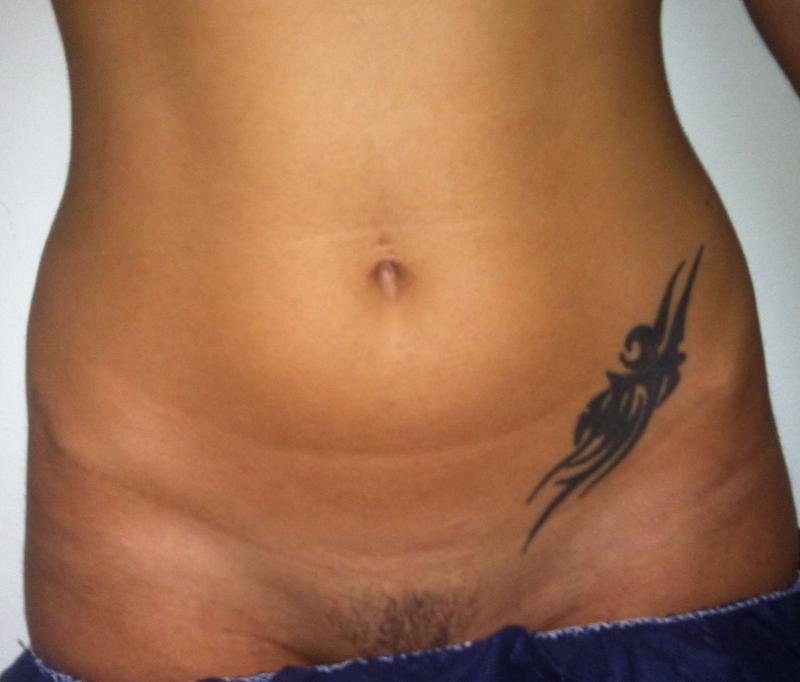 Plastic Surgery Egypt,Cosmetic Surgery Egypt, Aesthetic Surgery Egypt, Tattoo 