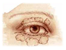 Egypt, Cairo, Plastic, Cosmetic, Surgery, face, Nose, Breast, Liposuction, hand