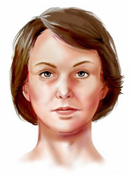 Egypt, aesthetic surgery, cosmetic surgery, Dr. Adel Wilson, neck lift, face lif