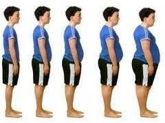 Cosmetic surgery Egypt, morbid Obesity, weight loss, body lift